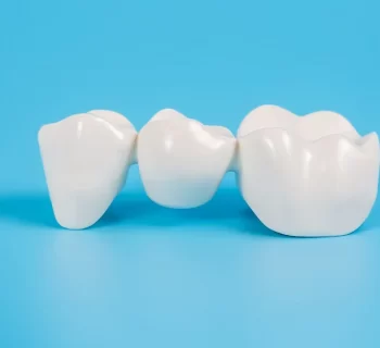 Dental Bridge – A Perfect Solution to Replace Missing Teeth