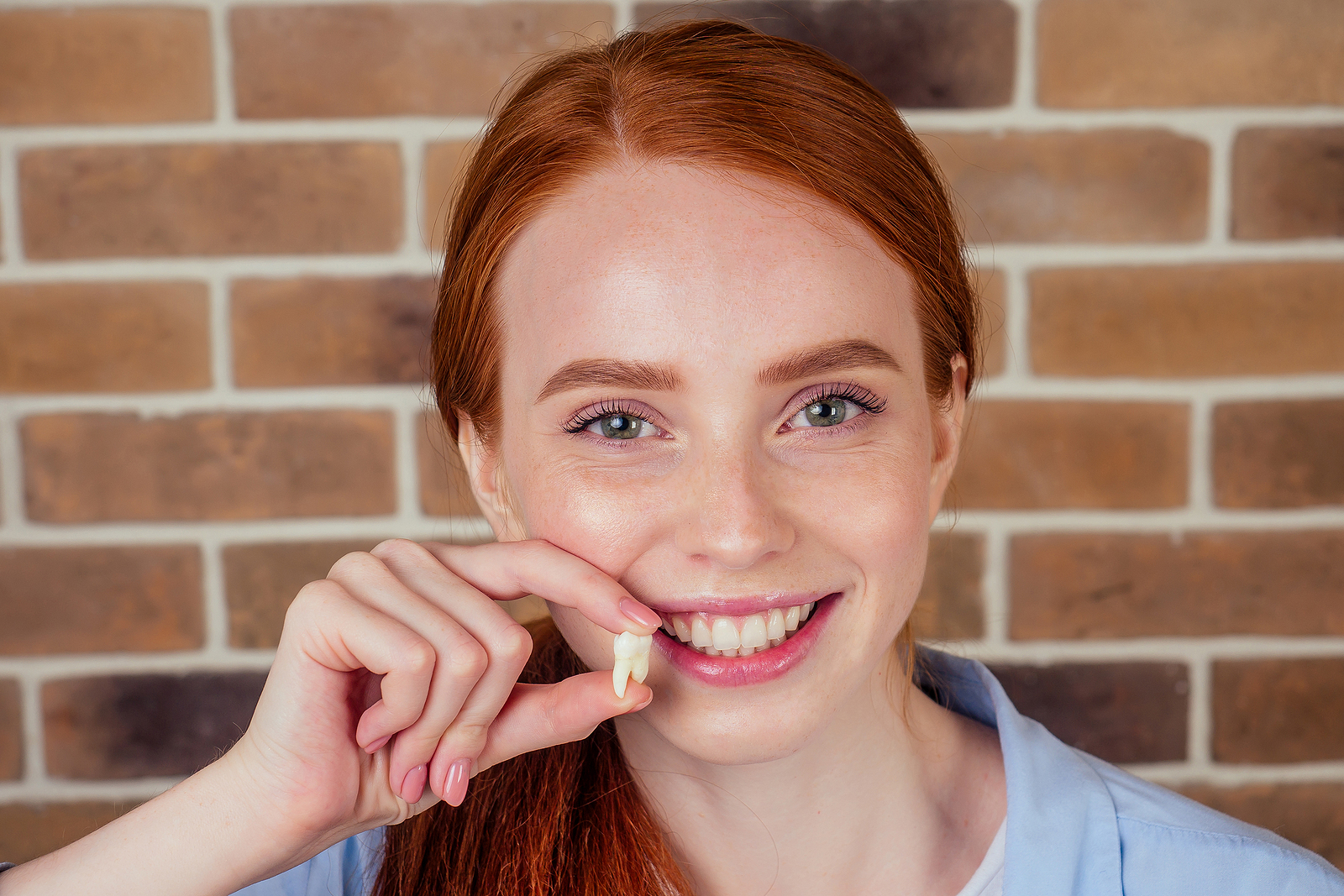 Do Wisdom Teeth Always Have to Be Removed?