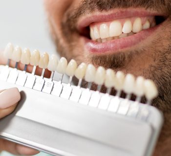 Can Veneers Be Removed?
