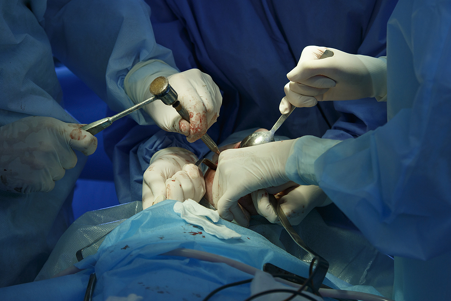 Understanding Oral Maxillofacial Surgery: Procedures, Benefits, and Recovery
