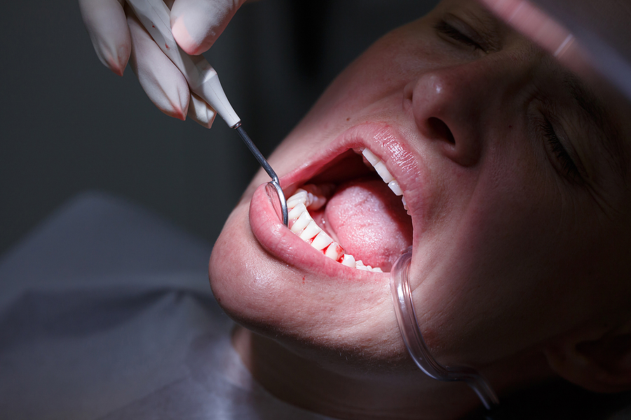 Comprehensive Guide to Periodontal Disease Treatment: Restoring Gum Health