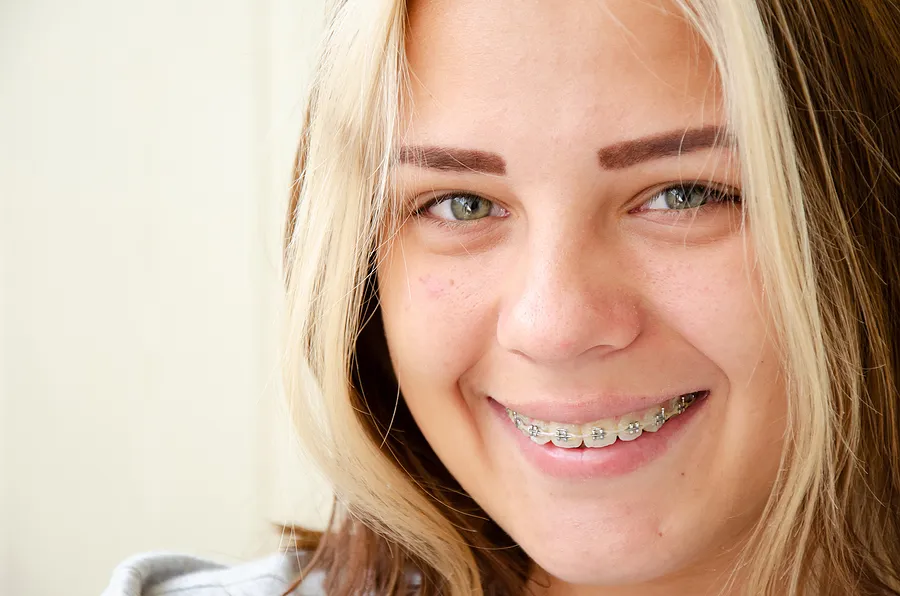 Why Do the Corners of My Lips Crack in Houston TX?