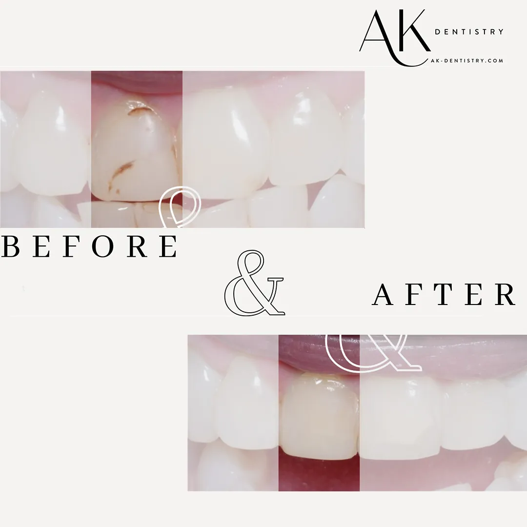 Before and After Image