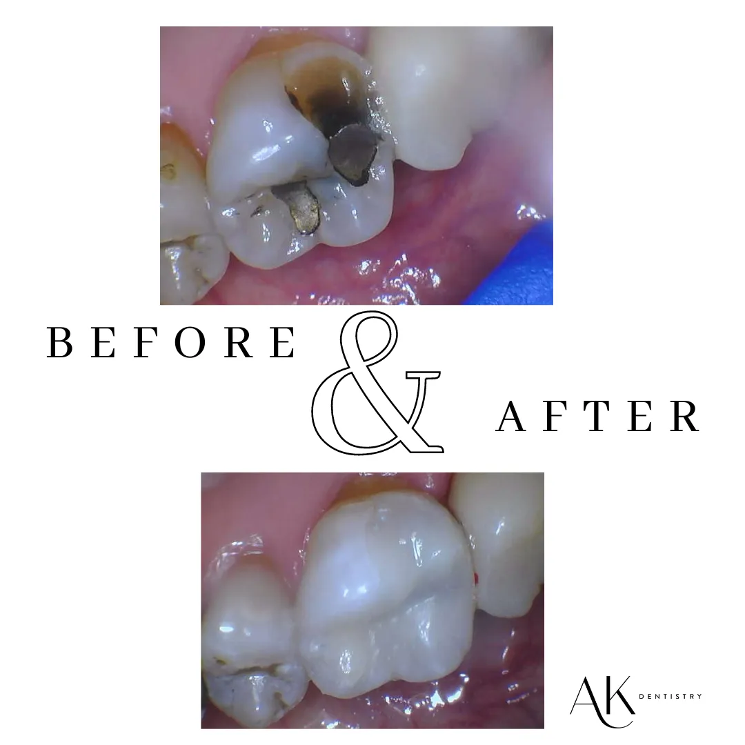 Before and After Image