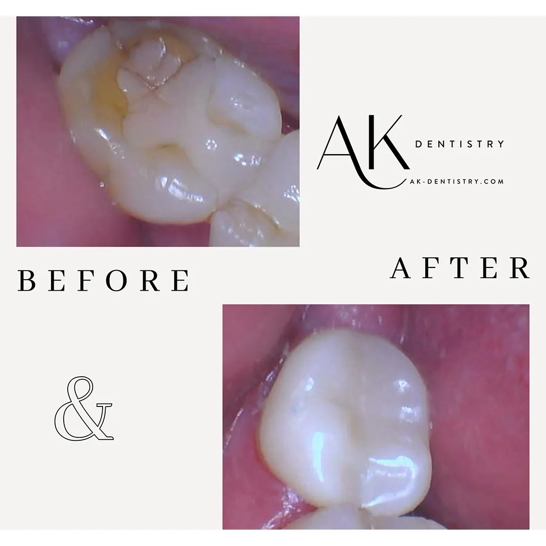 Before and After Image