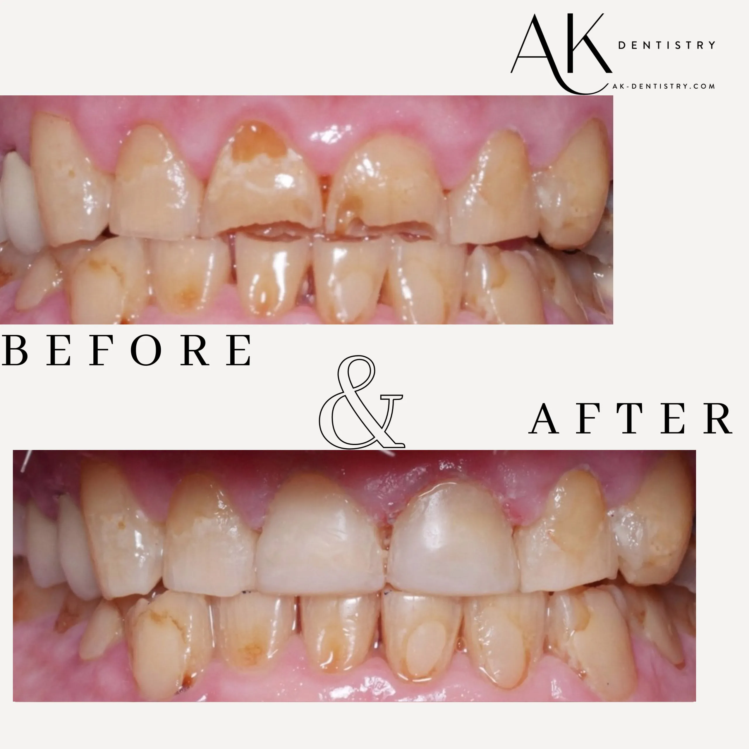 Before and After Image